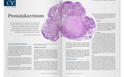 DFP-Lite­ra­tur­stu­dium: Prostatakarzinom