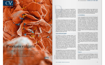 DFP-Literaturstudium: Psoriasis vulgaris