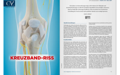 DFP-Literaturstudium: Kreuzband-Riss