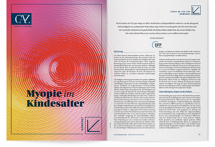 DFP-Literaturstudium: Myopie im Kindesalter