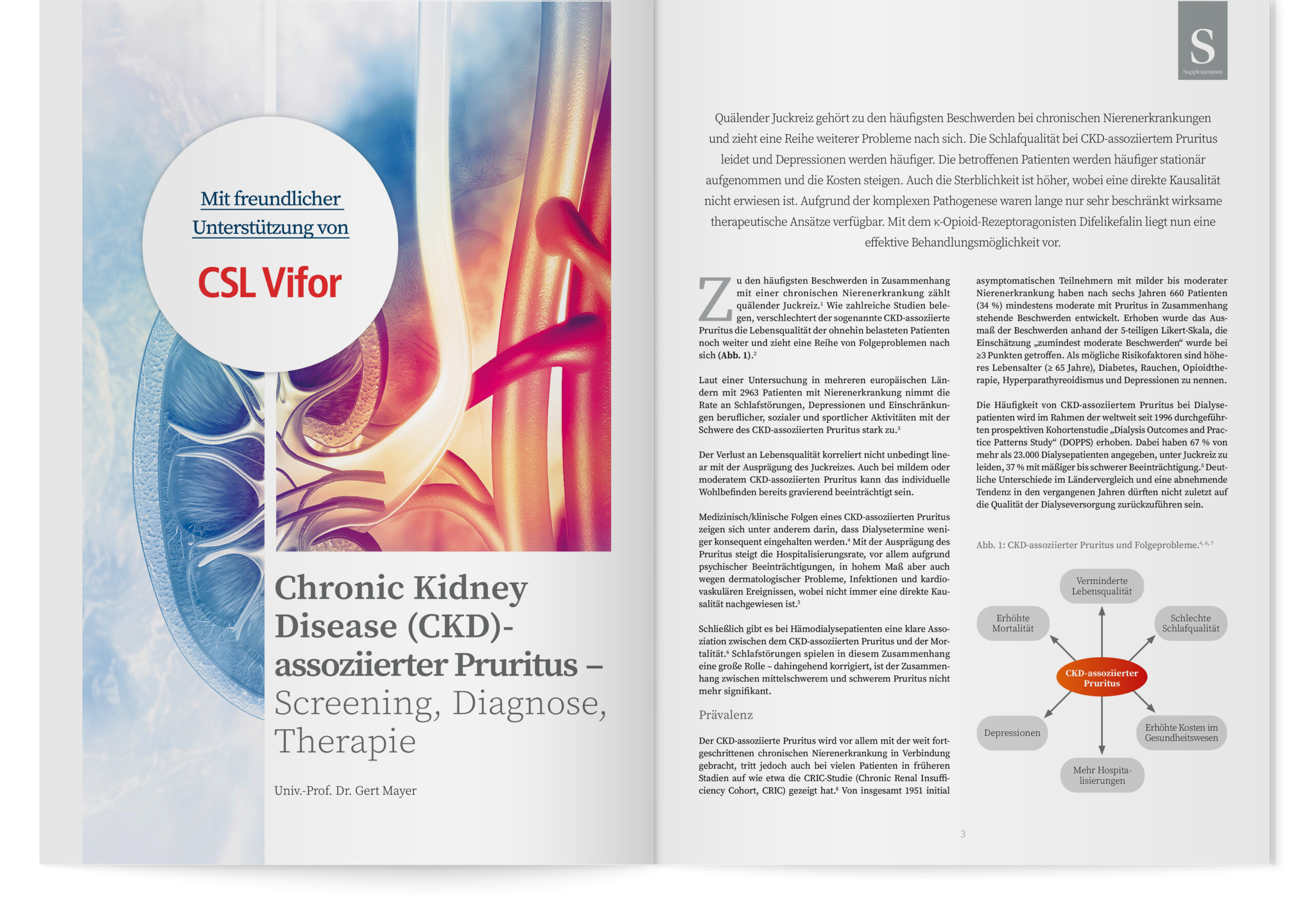 DFP-Supplementum: Chronic Kidney Disease (CKD)-Assoziierter Pruritus – Screening, Diagnose, Therapie