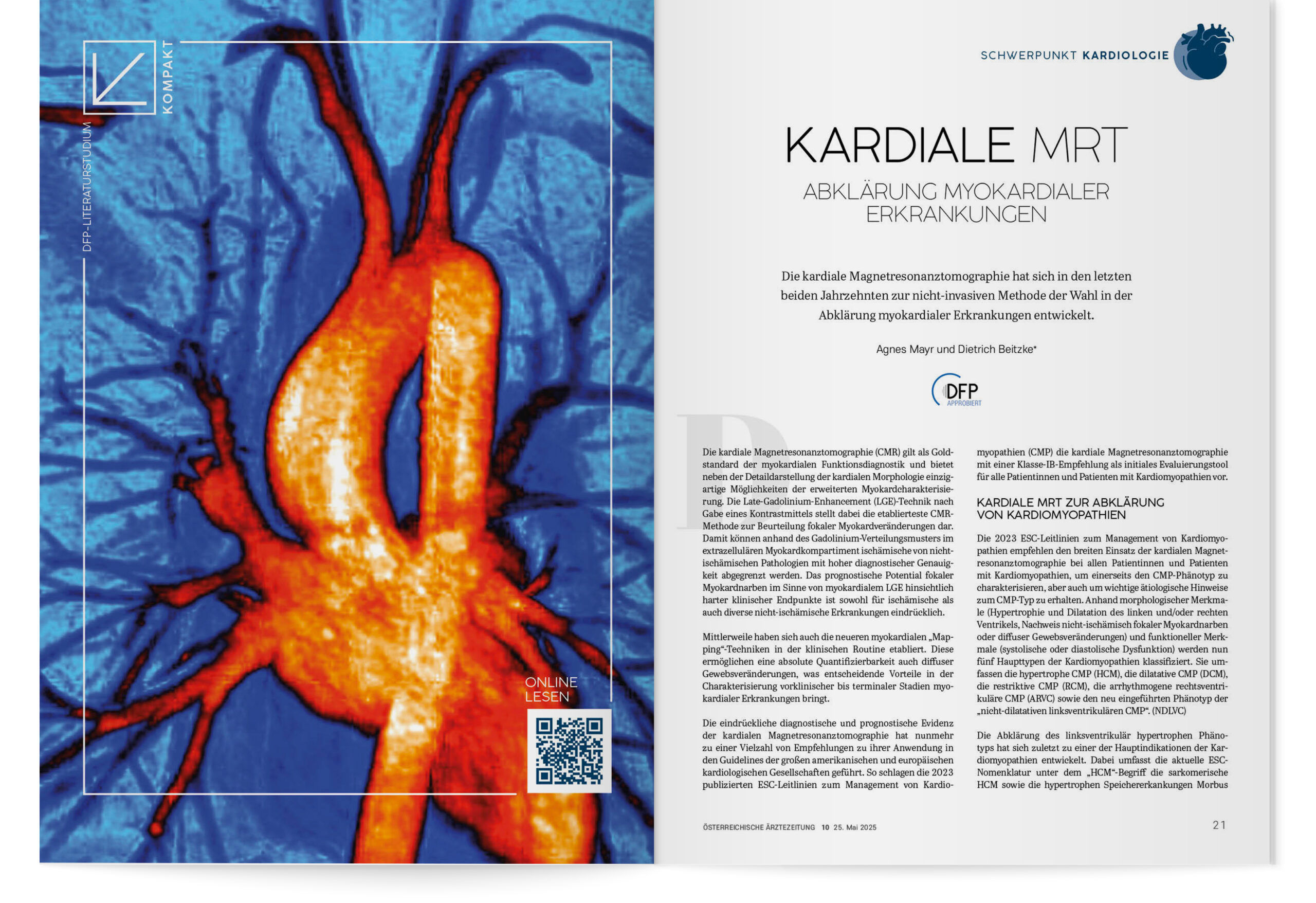 Schwerpunkt Kardiologie: DFP-Literaturstudium kompakt – Kardiale MRT – Abklärung myokardialer Erkrankungen