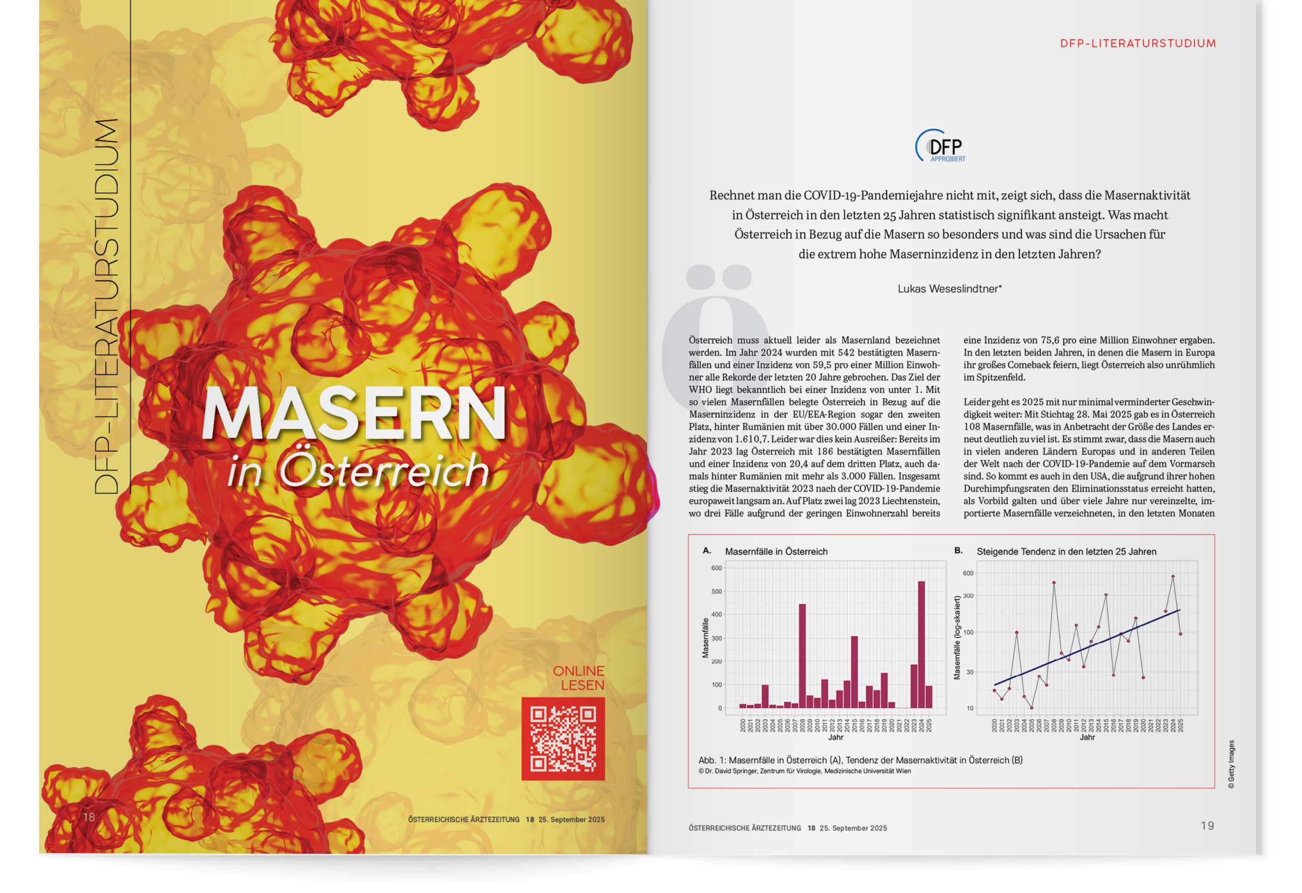DFP-Literaturstudium: Masern in Österreich