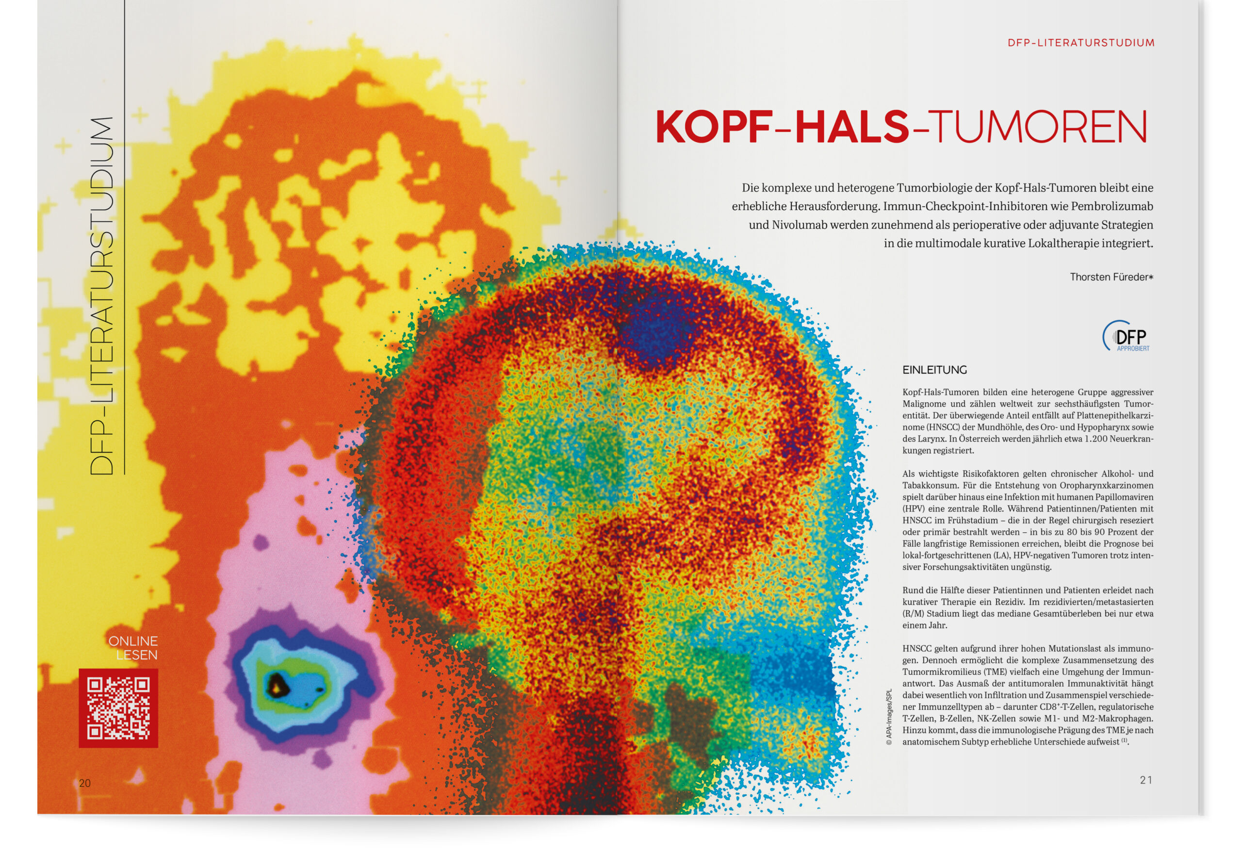 DFP-Literaturstudium: Kopf-Hals-Tumoren