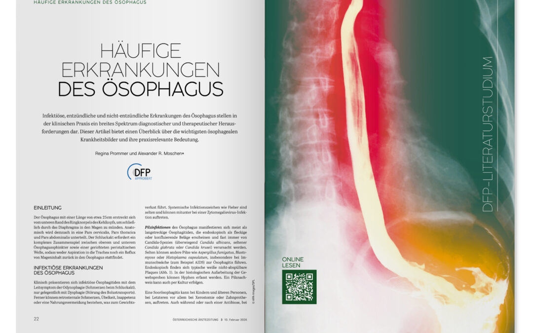 DFP-Literaturstudium: Häufige Erkrankungen des Ösophagus