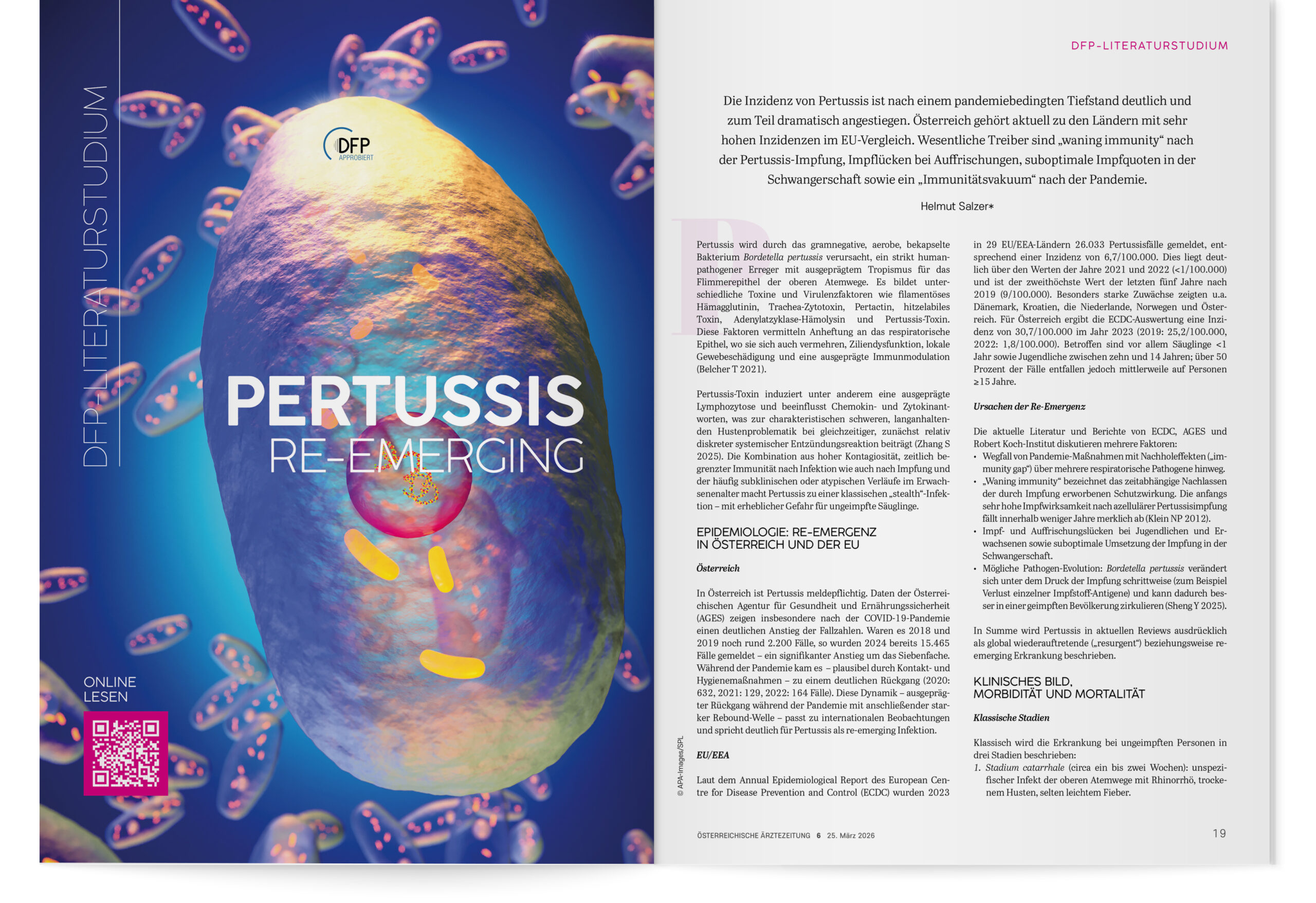 DFP-Literaturstudium: Pertussis re-emerging